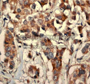 merck millipore,默克密理博,MABT147,Anti-MMP-12 (CT) Antibody, clone EP1261Y, rabbit monoclonal