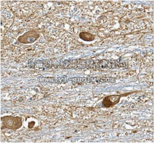merck millipore,默克密理博,MABT161,Anti-Versican Antibody, clone 8D8.1