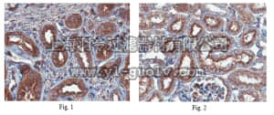 merck millipore,默克密理博,MABT162,Anti-Pinch-1 Antibody, clone 9D2.1