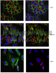 merck millipore,默克密理博,MABT166,Anti-Tom20/Tomm20 Antibody, clone 2F8.1