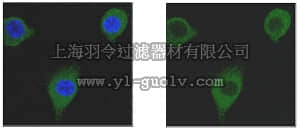 merck millipore,默克密理博,MABT167,Anti-Transgelin/SM22a Antibody, clone 20F2.2
