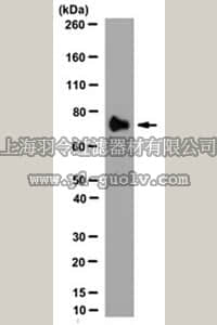 merck millipore,默克密理博,MABT171,Anti-MMP-9 (Active) Antibody, clone 4A3
