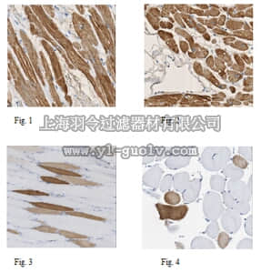 merck millipore,默克密理博,MABT180,Anti-MLC-2 Antibody, clone 19D3.1