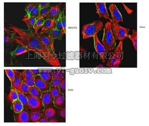 merck millipore,默克密理博,MABT205,Anti-α-Tubulin Antibody, clone DM1A