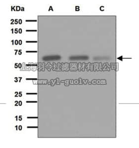 merck millipore,默克密理博,MABT208,Anti-Fyn Antibody, clone EPR5500, rabbit monoclonal