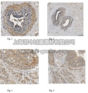 merck millipore,默克密理博,MABT379,Anti-Anoctamin-1/TMEM16A Antibody, clone 5F8.1
