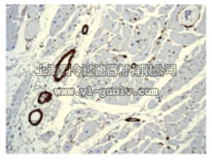 merck millipore,默克密理博,MABT381,Anti-Alpha-Actin (smooth muscle) Antibody, clone EPR5368, rabbit monoclonal