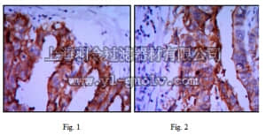 merck millipore,默克密理博,MABT457,Anti-ALPP Antibody, clone 3E5