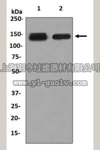 merck millipore,默克密理博,MABT470,Anti-DSG3, clone EPR7420, Rabbit Monoclonal Antibody