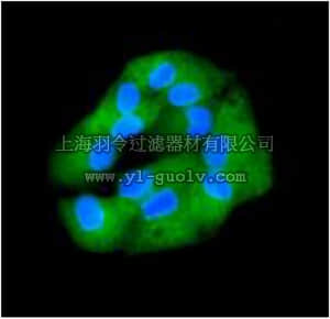 merck millipore,默克密理博,MABT472,Anti-Glypican-3, clone EPR5547, Rabbit Monoclonal Antibody