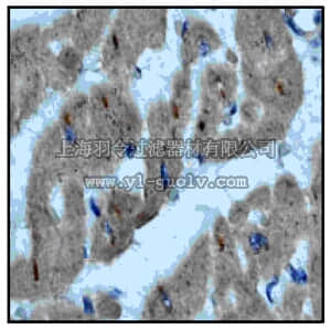 merck millipore,默克密理博,MABT66,Anti-ILK Antibody, clone EP1593Y rabbit monoclonal