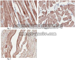 merck millipore,默克密理博,MABT75,Anti-Titin (NT/Z-domain) Antibody, clone 17D11.1