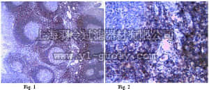 merck millipore,默克密理博,MABT77,Anti-Thymosin beta-4 Antibody, clone 1H2.1