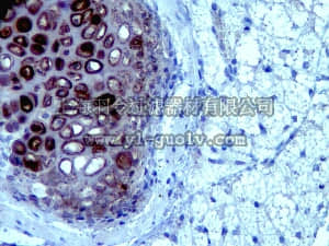 merck millipore,默克密理博,MABT85,Anti-Link Protein 1 (Crtl1) Antibody, clone 8-A-4