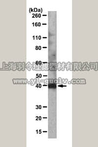 merck millipore,默克密理博,MABT87,Anti-Lumican Antibody, clone LUM-1