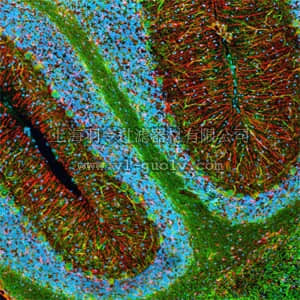 merck millipore,默克密理博,NE1023,Anti-Neurofilament H Non-Phosphorylated Mouse mAb (SMI-32)