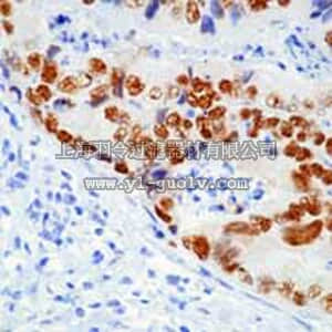 merck millipore,默克密理博,OP140,Anti-p53 (Ab-12) (Pantropic) Mouse mAb (DO-7)