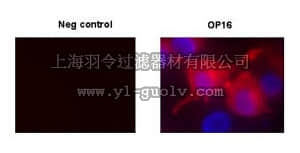 merck millipore,默克密理博,OP16,Anti-c-ErbB2/c-Neu (Ab-4) Mouse mAb (7.16.4)