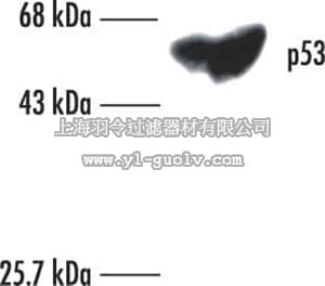 merck millipore,默克密理博,OP43,Anti-p53 (Ab-6) (Pantropic) Mouse mAb (DO-1)
