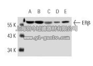 merck millipore,默克密理博,PC168,Anti-Estrogen Receptor β (Ab-1) (485-503) Rabbit pAb