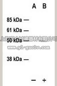 merck millipore,默克密理博,PC386,PhosphoDetect™ Anti-p53 (pSer¹⁵) (Ab-3) Rabbit pAb