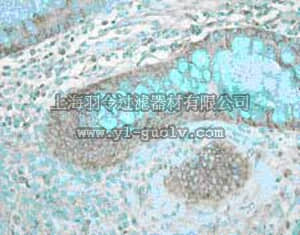 merck millipore,默克密理博,PC450,PhosphoDetect™ Anti-Tie2 (pTyr 1108/1117) (Ab-2) Rabbit pAb