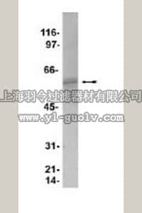 merck millipore,默克密理博,ST1088,Anti-Akt, PH Domain Mouse mAb (SKB1)