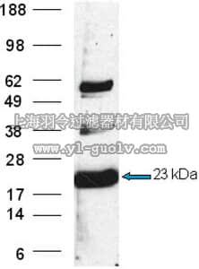 merck millipore,默克密理博,ST1504,Anti-TCTP Rabbit pAb