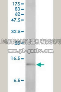 merck millipore,默克密理博,ST1506,Anti-SAA1 Mouse mAb (3C11-2C1)