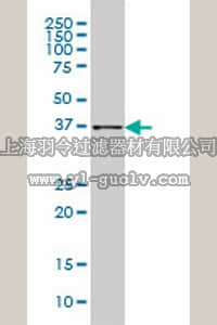 merck millipore,默克密理博,ST1507,Anti-AKR1B10 Mouse mAb (1A6)