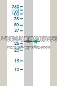 merck millipore,默克密理博,ST1513,Anti-EDN3 Mouse mAb (2A6-2A4)