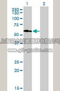 merck millipore,默克密理博,ST1517,Anti-PIP5K3 Mouse mAb (6C7)