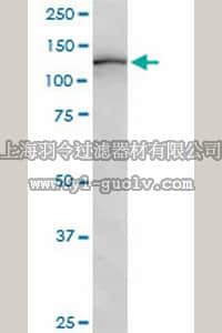 merck millipore,默克密理博,ST1521,Anti-ULK1 Mouse mAb (2H8)