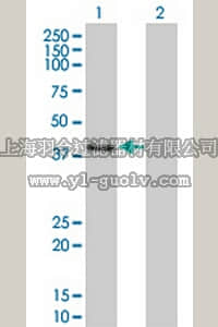 merck millipore,默克密理博,ST1523,Anti-CLN3 Mouse mAb (1G10)