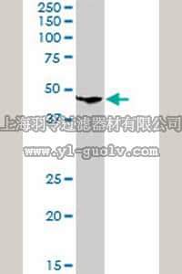 merck millipore,默克密理博,ST1524,Anti-CLN3 Rabbit pAb