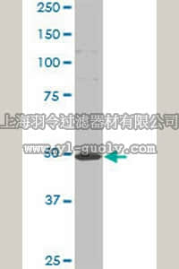 merck millipore,默克密理博,ST1529,Anti-HTT Mouse mAb (3F1)