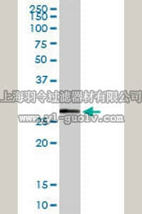 merck millipore,默克密理博,ST1535,Anti-NQO1 Rabbit pAb