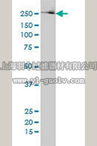 merck millipore,默克密理博,ST1549,Anti-FASN Mouse mAb (3F2-1F3)