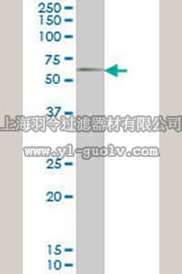 merck millipore,默克密理博,ST1551,Anti-GGT1 Mouse mAb (1F9)