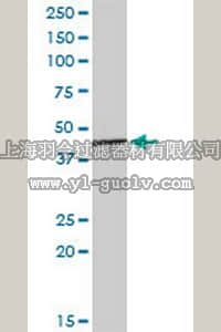 merck millipore,默克密理博,ST1554,Anti-AGER Mouse mAb (1C1)