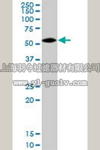 merck millipore,默克密理博,ST1555,Anti-AHSG Rabbit pAb