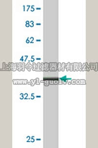 merck millipore,默克密理博,ST1558,Anti-ALOX12 Mouse mAb (2D10)
