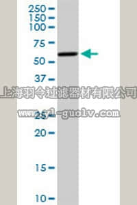 merck millipore,默克密理博,ST1564,Anti-CYP19A1 Rabbit pAb