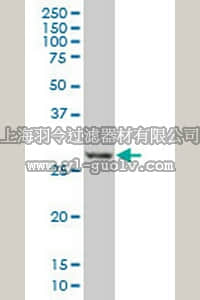 merck millipore,默克密理博,ST1569,Anti-DSCR1 Mouse mAb (1G7)