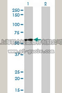 merck millipore,默克密理博,ST1578,Anti-IMPDH2 Mouse mAb (1E12-B6)