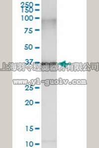 merck millipore,默克密理博,ST1594,Anti-SMN2 Rabbit pAb merck millipore,默克密理博,ST1594,Anti-SMN2 Rabbit pAb