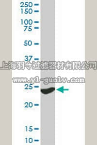 merck millipore,默克密理博,ST1598,Anti-YWHAG Mouse mAb (6A10)