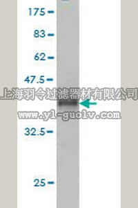 merck millipore,默克密理博,ST1600,Anti-ADAM12 Mouse mAb (1G3)