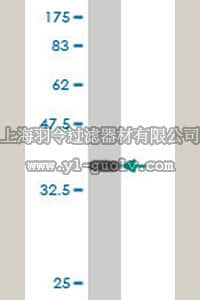 merck millipore,默克密理博,ST1604,Anti-ADAMTS1 Mouse pAb (1B8)