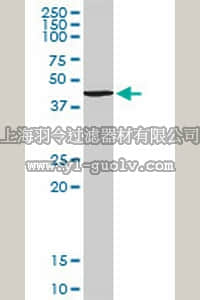 merck millipore,默克密理博,ST1608,Anti-TANK Rabbit pAb